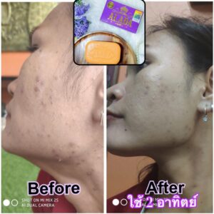 Alada Soap
