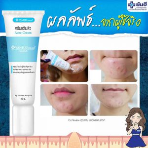Yanhee-acne-cream