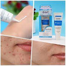 Yanhee-acne-cream