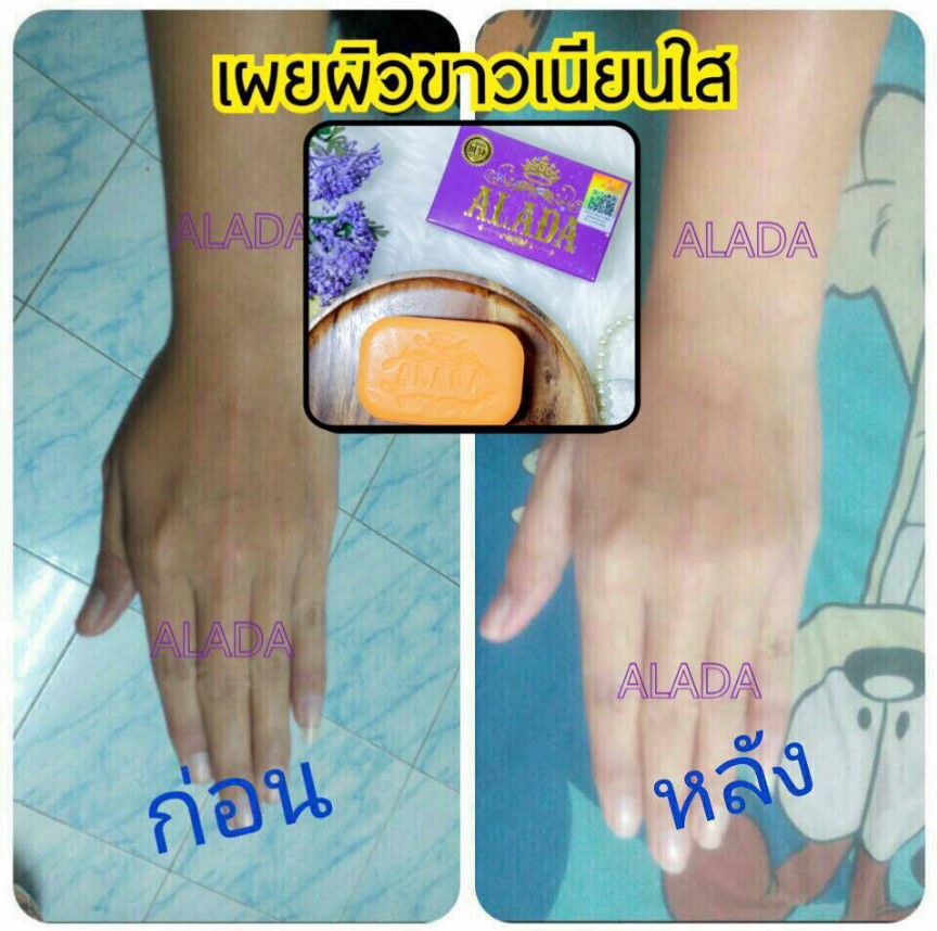 Alada Brightening Soap Thailand Skincare Product
