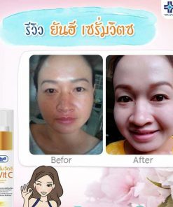 yanhee serum vit c