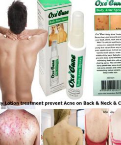 Alternative view of Oxe Cure Body Acne Spray