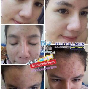 PWP Bio Skin Hylu Collagen 10ml Hyaluronic Acid Serum