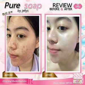 Pure-Soap-By-Jellys