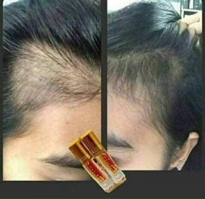 Genive Eyelashes Eyebrows Mustache Hair Growth Serum