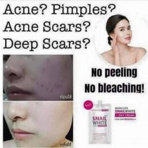 Snail White Whitening Anti-Pollution Day Cream SPF20 PA+++ 6 Sachets Box Set