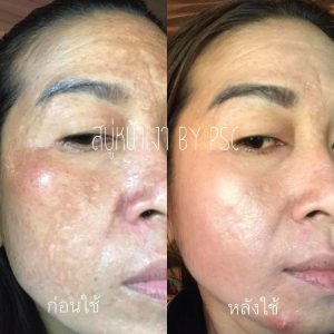 Princess Skin Care Aura Aura Soap