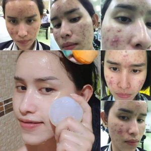 Princess Skin Care Aura Aura Soap