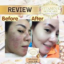 Vitamin E Skincare By Nifty