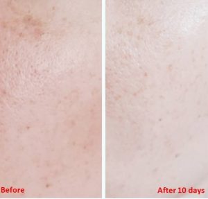 Taiyou No Aloe Hyaluronic Acid