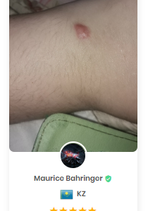 Lanbena TCM Scar And Acne Mark Removal Gel Ointment 30g