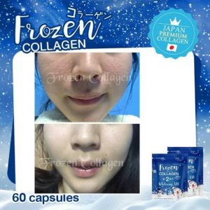 Frozen Collagen
