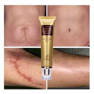 Lan Be Na TCM Scar And Acne Mark Removal Gel Ointment
