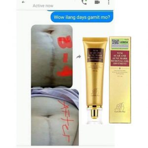 Lan Be Na TCM Scar And Acne Mark Removal Gel Ointment