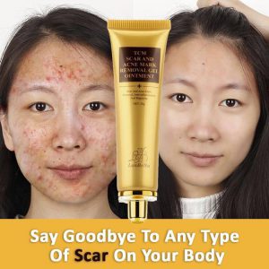 Lan Be Na TCM Scar And Acne Mark Removal Gel Ointment