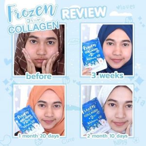 Frozen Collagen