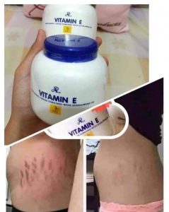 AHA Serum and Vitamin E Cream set