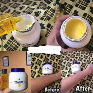 MIMI White AHA Body Serum 30ml and Aron Vitamin E Cream 200g set