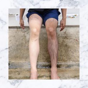 Cho Ar Hair Removal White Mask