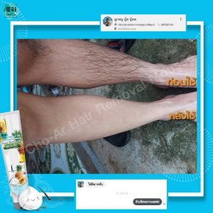 Cho Ar Hair Removal White Mask