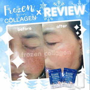 Frozen Collagen