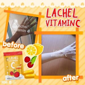 Lachel Vitamin C