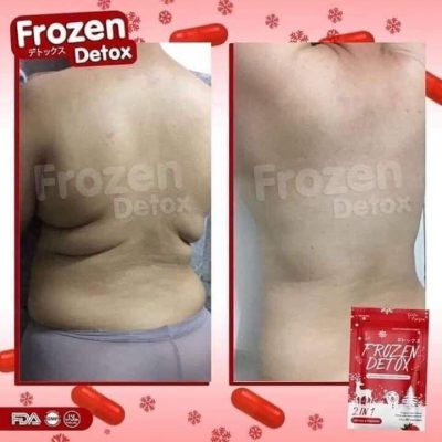 Frozen Detox