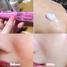 Skinrx Lab Re-turn Cream Set