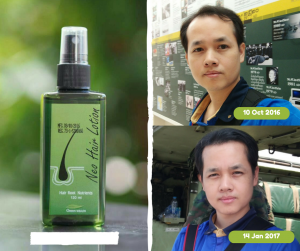 Neo Hair Lotion