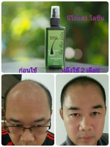 Neo Hair Lotion