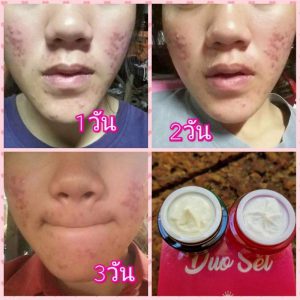 Princess Skin Care Triple Set