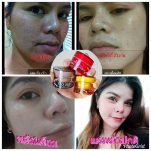 Princess Skin Care Triple Set