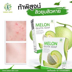 Melon Acne Soap