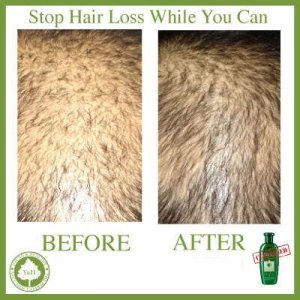 Bsc Falless Hair Reviving Shampoo