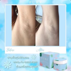 Pure Underarm Care