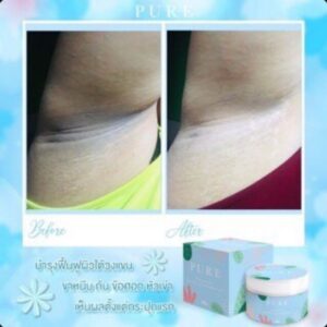 Pure Underarm Care