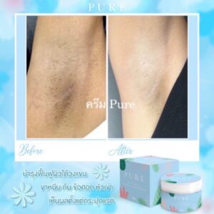 Pure Underarm Care