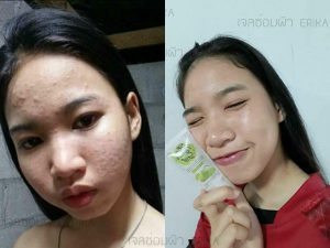 Erika Skin Repair Gel