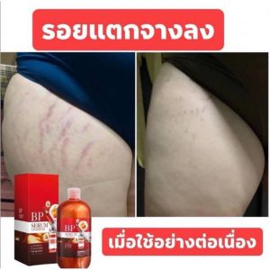 BP Serum Lycopene