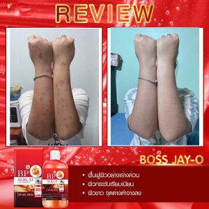 BP Serum Lycopene