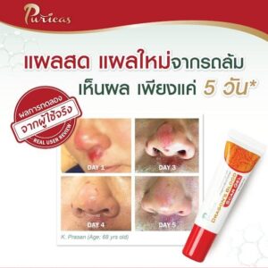 Puricas Dragon’s Blood Scar Gel 8g Concentrated Scar Care