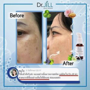 Dr.Jill G5 Essence Plus