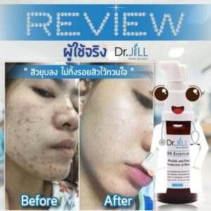 Dr.Jill G5 Essence Plus