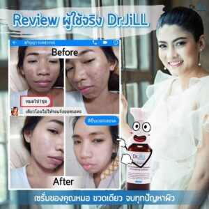 Dr.Jill G5 Essence Plus