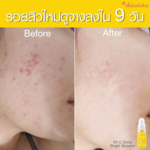 Skinsista C Extra Bright Booster