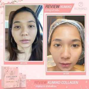 Kumiko Collagen