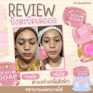 NB Serum Soap