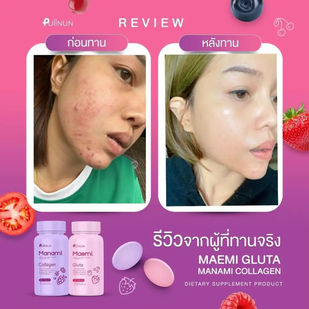 บอกบุญ🌈กลูต้า คอลลาเจน ที่เห็นผลจริง👏🏻👏🏻 | แกลเลอรีที่โพสต์โดย รีวิวครีมขาว | Lemon8