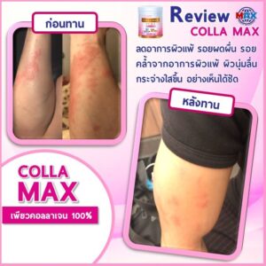 Wisamin Colla Max Plus