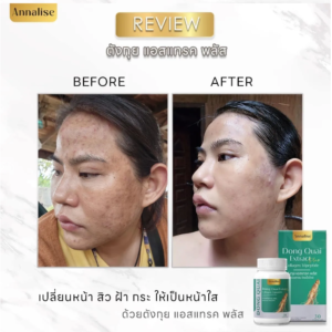 Annalise Dong Quai Extract